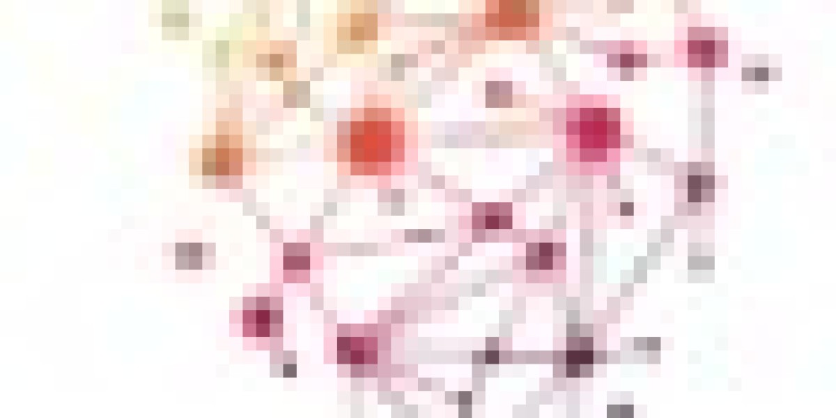 Reduce SharePoint Implementation Risks with Microsoft Experts