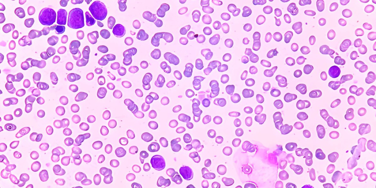 Emerging Therapies Revolutionizing the Thrombocytopenia Market