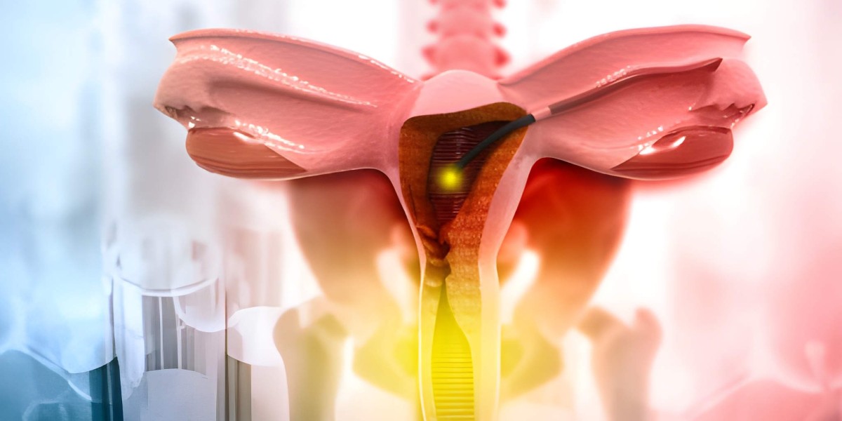 Pelvic Inflammatory Disease Explained: Causes, Detection, and Care Approaches