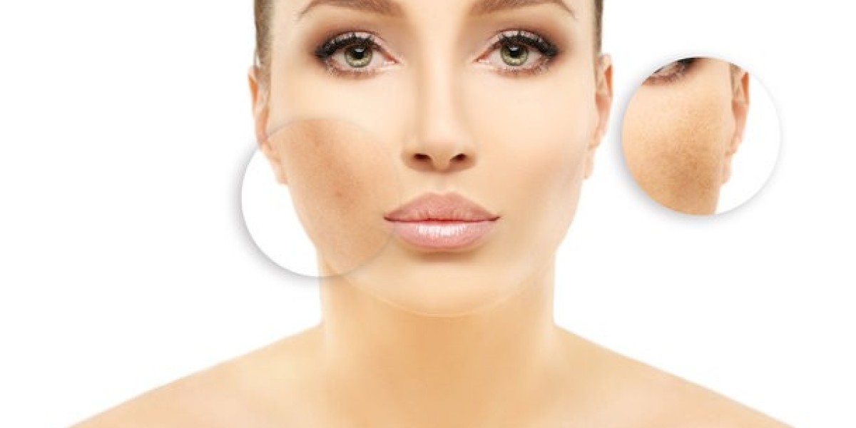 What is Melanin? The Science Behind Skin Color and Discoloration