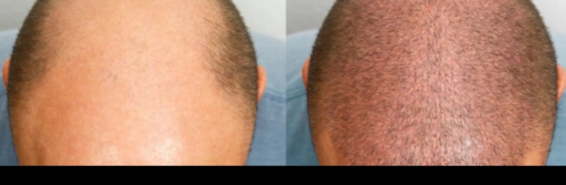 Myhair Line Cover Image